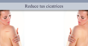 Reduccin y eliminacin de cicatrices