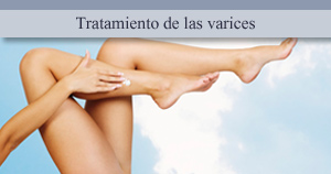 Tratamiento de las varices